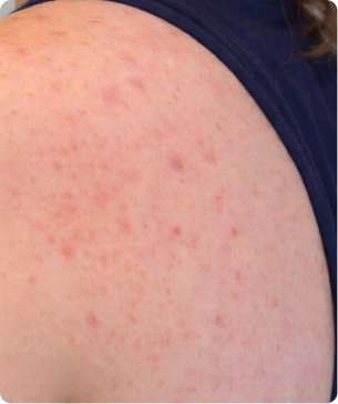 Promotes healthier-looking, more balanced skin over time.